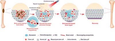 Biomaterial-based strategy for bone tumor therapy and bone defect regeneration: An innovative application option
